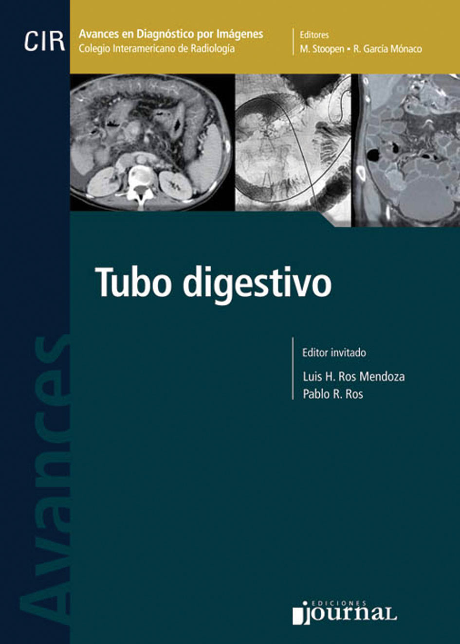 CIR Tubo Digestivo